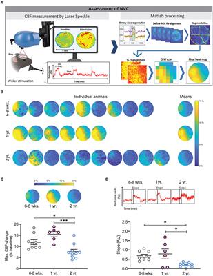 Neurovascular Reactivity in the Aging Mouse Brain Assessed by Laser Speckle Contrast Imaging and 2-Photon Microscopy: Quantification by an Investigator-Independent Analysis Tool